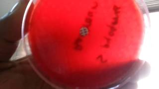 Bacitracin test for Streptococcus pyogenes [upl. by Valenta954]