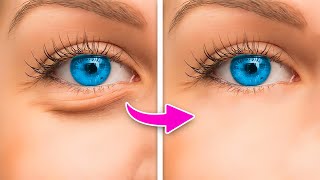 HOW TO MAKE UNDER EYE BAGS DISAPPEAR IN SECONDS [upl. by Lewison]