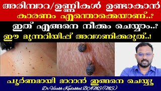 ശരീരത്തിൽ ഉണ്ടാകുന്ന ഉണ്ണികൾ Skin Tag പൂർണമായി മാറാനുള്ള എളുപ്പ വഴികൾ  Dr Visakh Kadakkal [upl. by Aztinay]