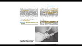 emergency care  chap 3  Airway Management PART1 [upl. by Jameson196]