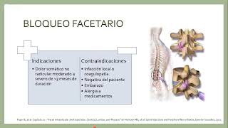 Bloqueos espinales en la región lumbar [upl. by Atirhs]