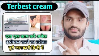 Terbest cream use benefits and Side effects full review in hindiTerbinafine 1 [upl. by Erdna]