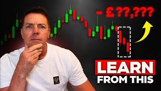 What my biggest trading losses taught me [upl. by Troxell]