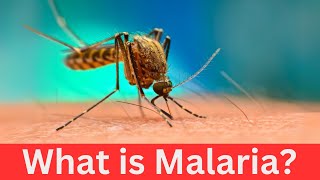 What is Malaria [upl. by Knowle567]