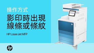 影印時出現線條或條紋  HP LaserJet MFP [upl. by Templeton]