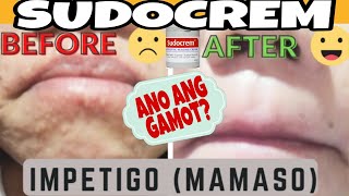 SUDOCREM EFFECTIVE amp PERFECT CREAM FOR SENSITIVE SKIN  Nhors Alde mamaso impetigo skinallergy [upl. by Sterne]