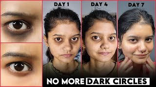 Get Rid of DARK CIRCLES Naturally in 7 Days  Permanent Solution of Dark Circle  Remove Dark Circle [upl. by Yasdnil535]