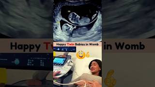 Emotional Twin Ultrasound Scan 🥰💯 Twin ultrasound pregnancy [upl. by Brenk483]