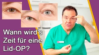 AugenlidOP – Ab wann ist OP sinnvoll Gibt es Alternativen ohne OP Dr Günther Düsseldorf [upl. by Markos]