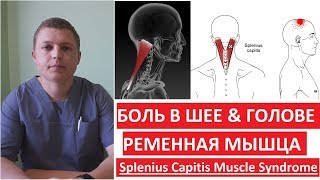 Ременная мышца  Как лечить боль в шее и голове  Splenius Capitis Muscle Syndrome [upl. by Eatton]