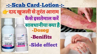 Scab card lotion use in hindi दाद खुजली को जड़ से खत्म करे medicine medical raj pharmacy use [upl. by Aihsenod]