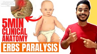 erbs paralysis clinical anatomy of brachial plexus  brachial plexus clinical anatomy [upl. by Samp]