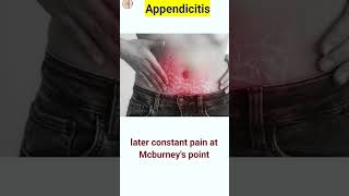 Appendix pain  appendicitis  shorts shortsfeed [upl. by Johnathon]