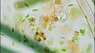 Freshwater Hypotrich  Possibly Euplotes [upl. by Enomas]