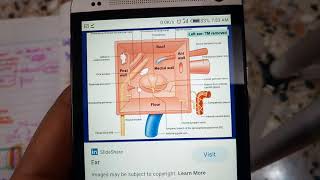 CHRONIC SUPPURATIVE OTITIS MEDIA part 1 general explanation with types must watch to get it [upl. by Ekul]