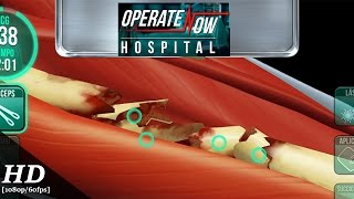 Operate Now Hospital Android Gameplay 1080p60fps [upl. by Htirehc202]