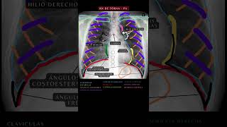 Radiografía de Tórax PA  Anatomía del Tórax radiografía anatomía medicina [upl. by Hamnet580]