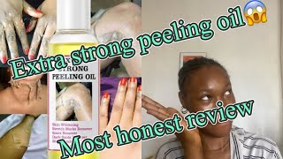 Extra strong peeling oilchemicalpeelinghonestreview [upl. by Samuelson]