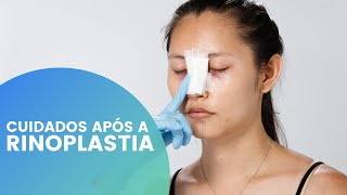 CUIDADOS IMPORTANTES APÓS A RINOPLASTIA O QUE POSSO OU NÃO FAZER [upl. by Aihtniroc461]