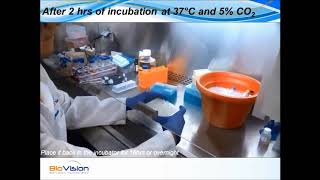 Cholesterol Efflux Fluorometric Assay Kit cellbased Video Protocol  Biovision Inc [upl. by Hitt201]