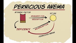 Pernicious anemia [upl. by Wehrle]