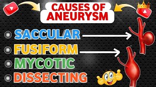 Understanding  Causes Of Aneurysm 😍 [upl. by Rika151]