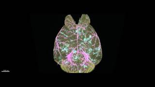 WholeBrain Imaging of Cancer Metastasis VIDEO [upl. by Anitsyrhc862]