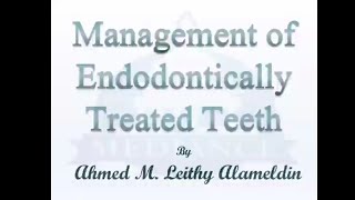 Management of Endodontically Treated Teeth part 1 [upl. by Anitteb]