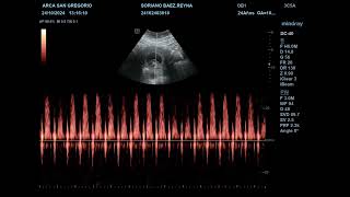 Frecuencia cardiaca embrionaria REYNA SORIANO BAEZ [upl. by Lossa99]