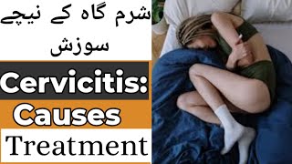 What is cervicitis Causes of Cervicitis sign and symptoms Treatment of Cervicitis in Hindi [upl. by Ttevy725]