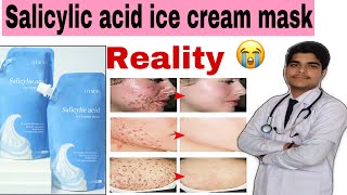 Salicylic acid ice cream mask review  open pores  acne  pimples  blackheads [upl. by Harbour]