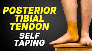 Posterior Tibial Tendonitis Taping  Posterior Tibial Tendon Dysfunction Taping [upl. by Pritchard429]