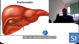 What are the causes of hypoprothrombinemia [upl. by Nuli]