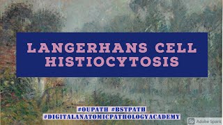 Langerhans Cell Histiocytosis [upl. by Medovich]