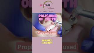 See the method of Polishing the teeth with prophy paste [upl. by Ritch798]