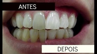 Clareamento dental com produto Oral B [upl. by Naaitsirhc]