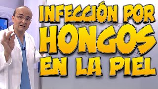 Alerta por bacterias en la cara que podrían afectar la salud de la piel [upl. by Hannasus]