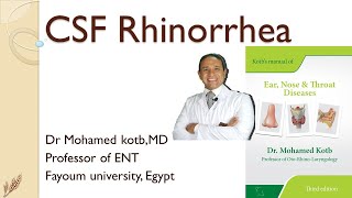 CSF rhinorrhea Professor Dr Qotb [upl. by Lorrin232]