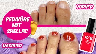 Pediküre mit UV Shellac Nagellack [upl. by Remmer]