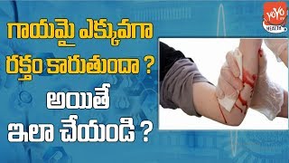 How To Heal Wounds Faster  How To Stop Bleeding  Telugu Health Tips  YOYO TV Health [upl. by Irolam]