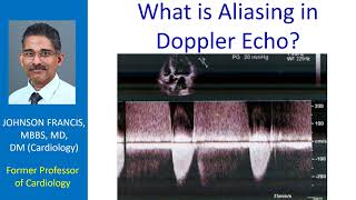 What is Aliasing in Doppler Echo [upl. by Croner]