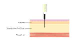 How to Give Yourself a Subcutaneous Injection An Introduction [upl. by Iphlgenia363]