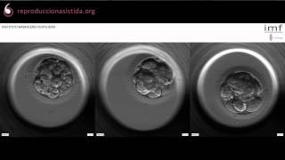 Imágenes de desarrollo del embrión  Embryoscope [upl. by Marilee]