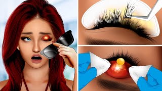 ASMR Eye Cleaning Remove Dirt Eyelash and Treating Infected Eye [upl. by Aran939]