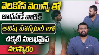 Best Varicose Veins Treatment In Telugu  How to Get Rid Varicose Veins In Telugu  SumanTV Prime [upl. by Adnilec]