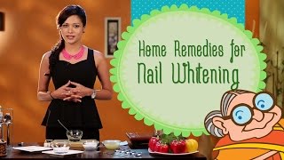 How To Whiten Your Nails With Top Home Remedies Nail Care [upl. by Christie]