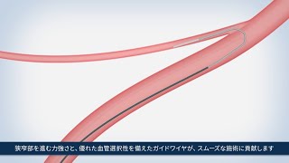 先進医療に貢献する医療用ガイドワイヤ [upl. by Oleta]