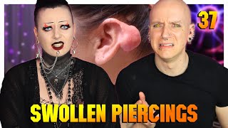 Reacting To Piercing Keloids amp Hypertrophic Scars ftToxic Tears  Piercings Gone Wrong 37  Roly [upl. by Othella]