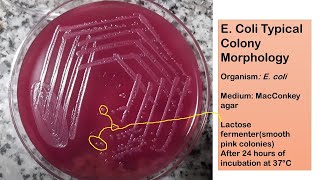 E coli typical colony morphology on Macconkey agar [upl. by Assilrac]