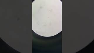 Gutierrez  Canal Water Microscope Video [upl. by Deena]